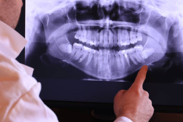 Best Emergency Cosmetic Dentistry in Lake Cassidy, WA