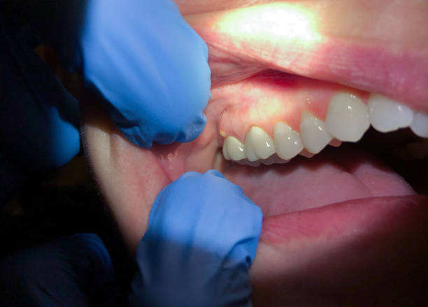  Lake Cassidy, WA Emergency Dentist Pros